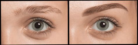 Illustration du processus de greffe de sourcils