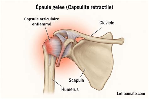 Illustration anatomique de l'épaule avec la capsule articulaire