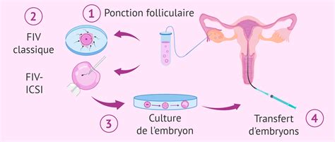 Schéma explicatif du processus de Fécondation In Vitro (FIV)