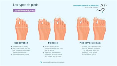 Schéma comparant différents types de pieds de poteaux (à platine, à visser, rond)