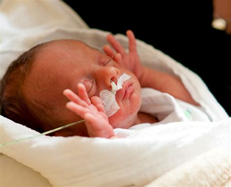 Nouveau-né prématuré enveloppé dans un sac en plastique transparent, sous une lampe chauffante