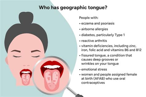 Image représentant une langue géographique